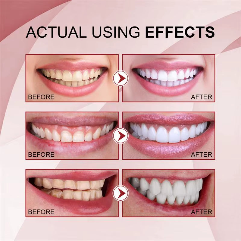 SP-6 Probiotic Toothpaste Whiten Clean Teeth Remove Stains Oral Care Management Fresh Breath with Sodium Saccharin Lactobacillus