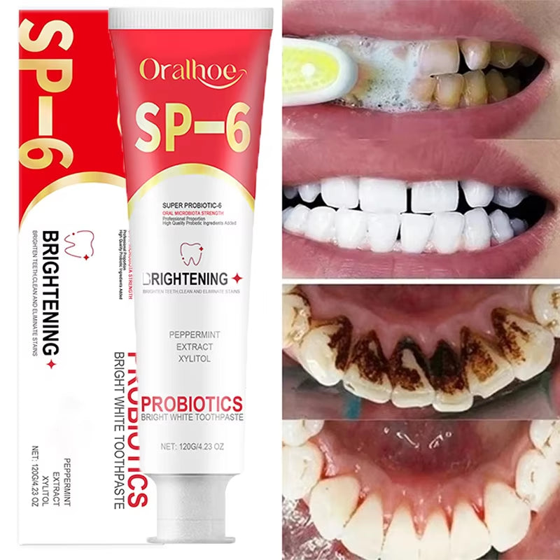 SP-6 Probiotic Toothpaste Whiten Clean Teeth Remove Stains Oral Care Management Fresh Breath with Sodium Saccharin Lactobacillus